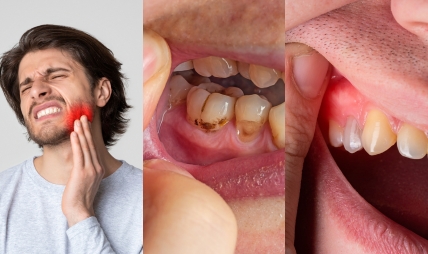 top signs you might need a root canal