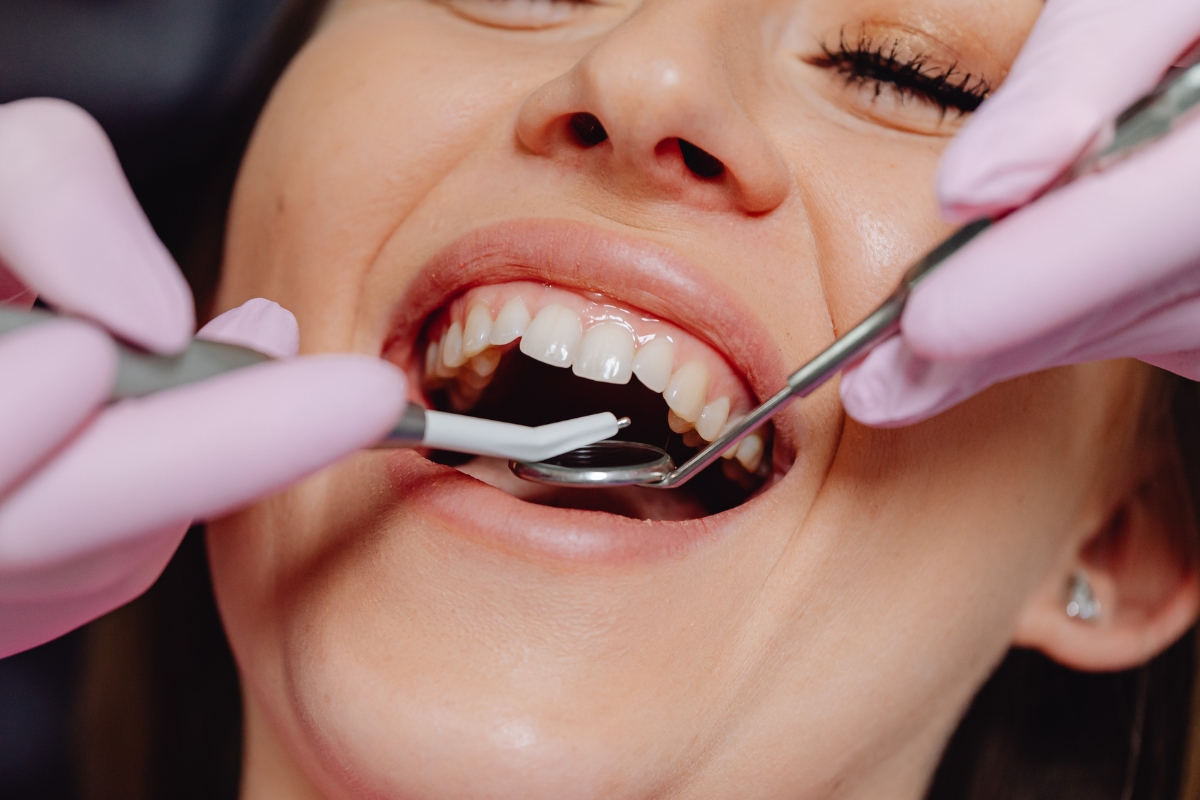 dental bridges in Pasadena