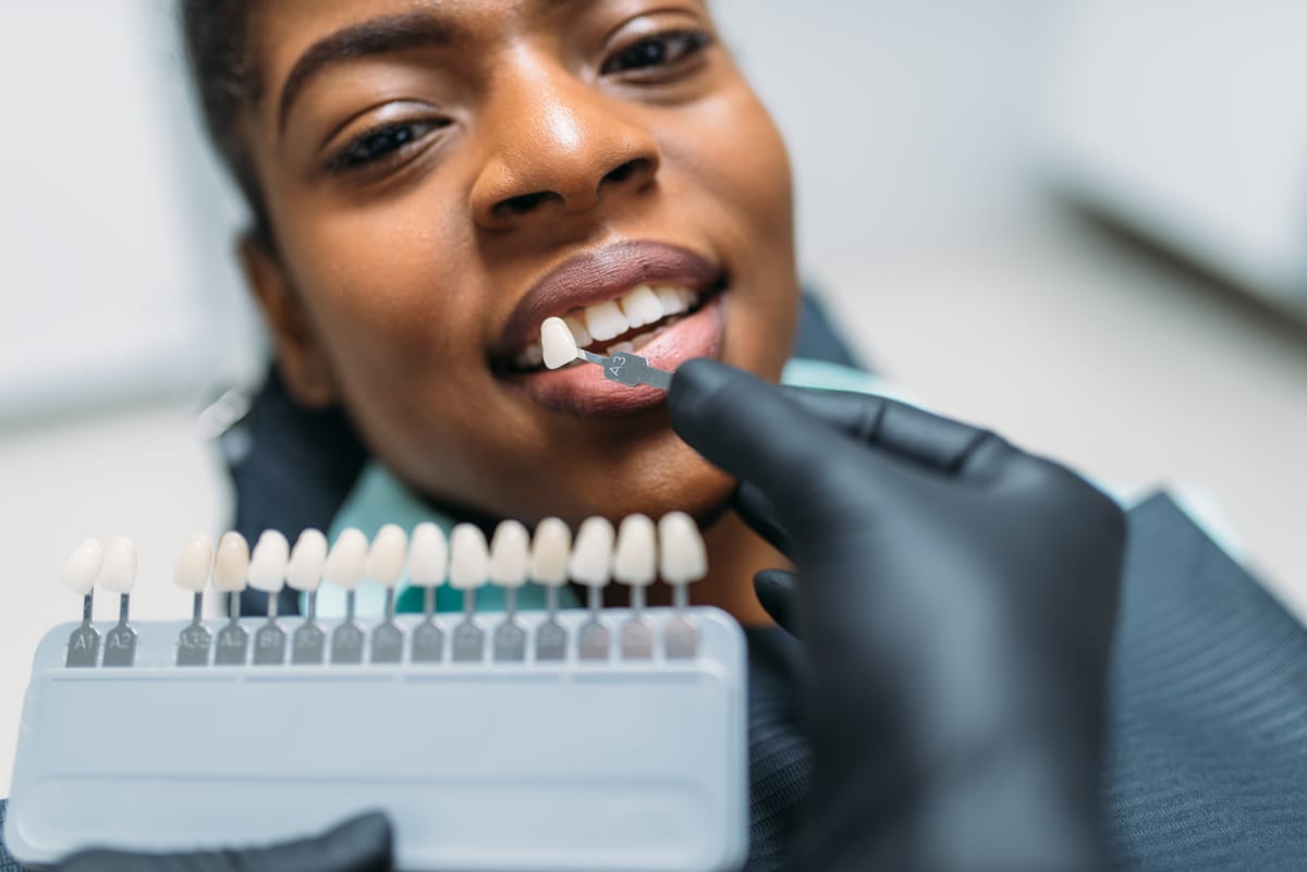 Veneers in Lake Shore